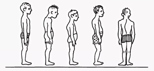 Violazione della postura