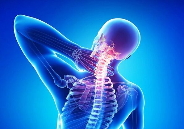 Dolore alla colonna cervicale con osteocondosi