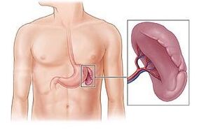 patologia della milza come causa di dolore sotto la scapola sinistra
