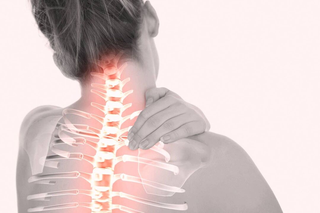 dolore al rachide cervicale dovuto all'osteocondrosi